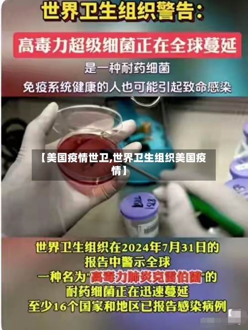 【美国疫情世卫,世界卫生组织美国疫情】