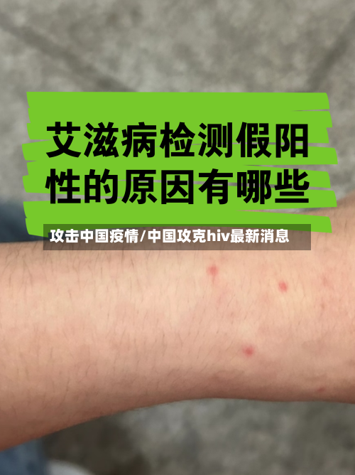 攻击中国疫情/中国攻克hiv最新消息-第2张图片