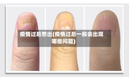 疫情过后憋出(疫情过后一般会出现哪些问题)